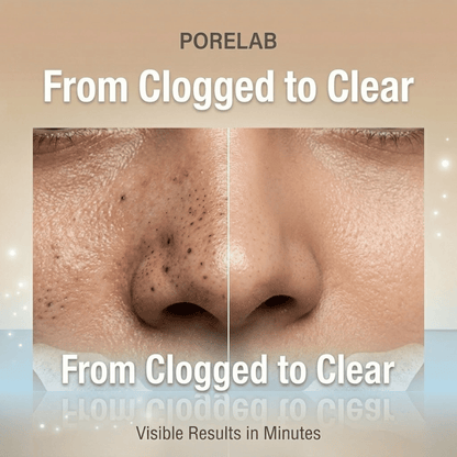 Porelab -Deep Pore Clearing System
