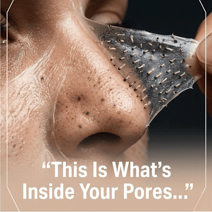 Porelab -Deep Pore Clearing System